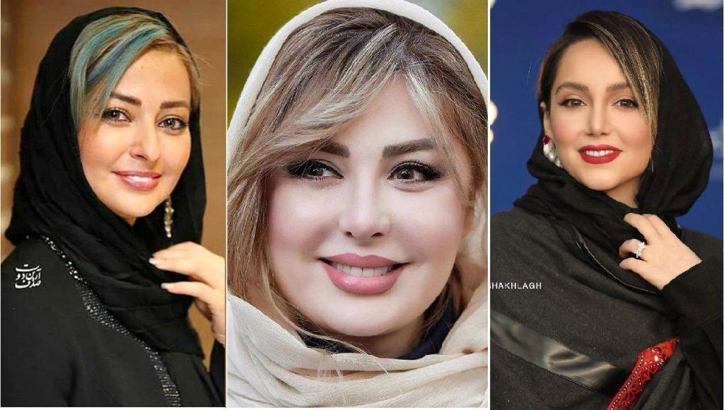 جراحی زیبایی پلک یا افتادگی پلک بازیگران ایرانی