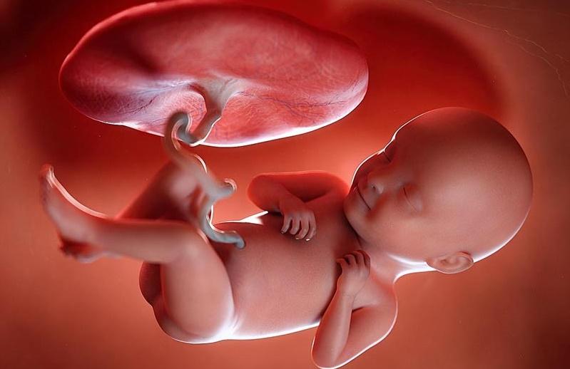 کشورهایی که دسترسی به اجرای سقط جنین به دلایل خودخواسته را در آن‌ها محدود می‌کنند