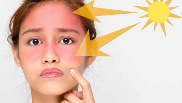 ایا کمبود ویتامین باعث لک صورت میشود