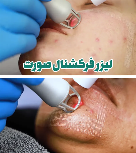 درمان لک صورت در مراکز درمانی 